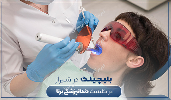قیمت بلیچینگ دندان در شیراز